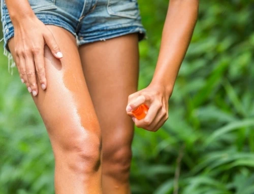 Treatment for Insect Stings and Bug Bites